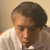 A photo of the head and shoulders of an indigenous man; one side of his head has been shaved for surgery and is extremely swollen